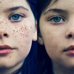 Removing Freckles and Blemishes in Photoshop